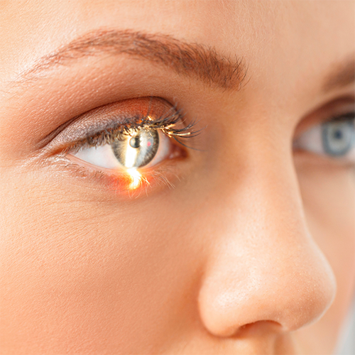 «Инновационная офтальмология»