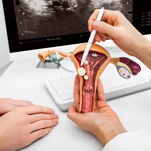 Консультация по лечению эндометриоза - бесплатно