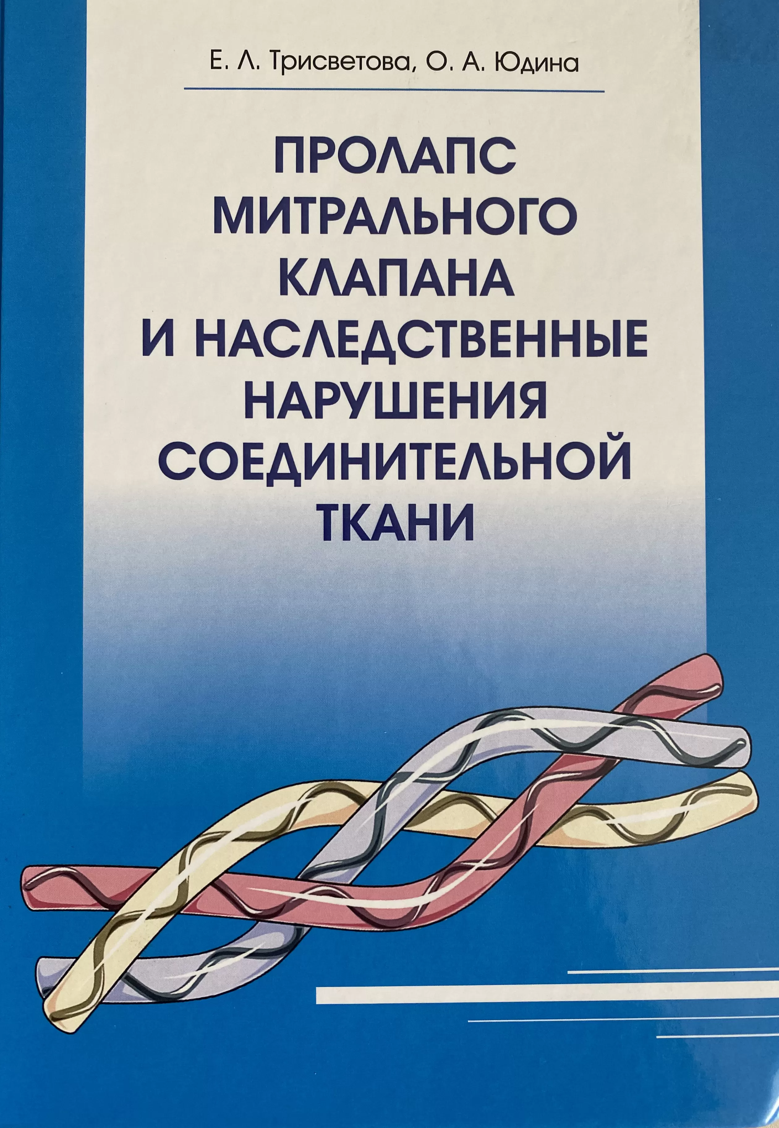 Пролапс митрального клапана и наследственные нарушения соединительной ткани